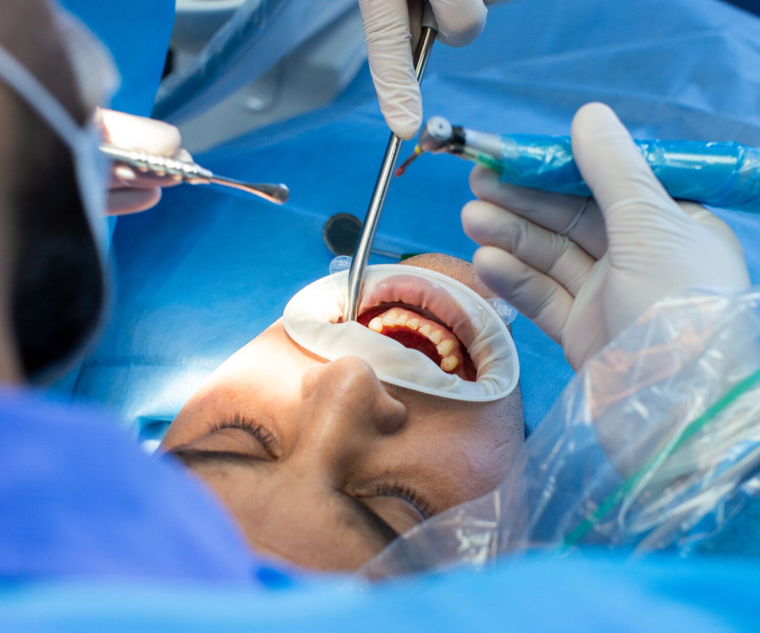 dentist and assistant with tool makes some manipulations in the patient's mouth