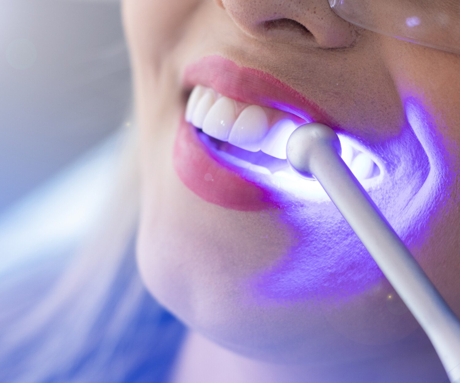 woman having her teeth checked by the dentist in an office